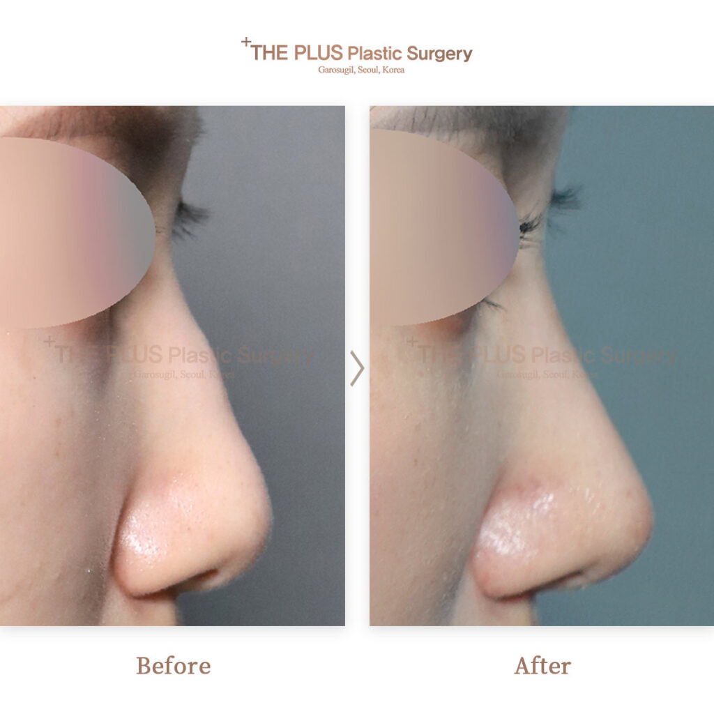 THE PLUS CLINIC KOREA -