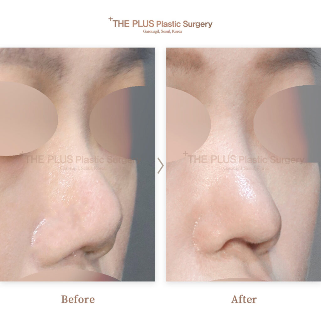 THE PLUS CLINIC KOREA -