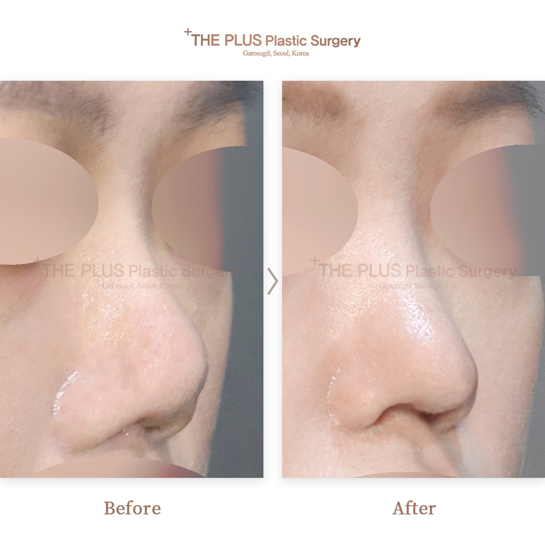 THE PLUS CLINIC KOREA -
