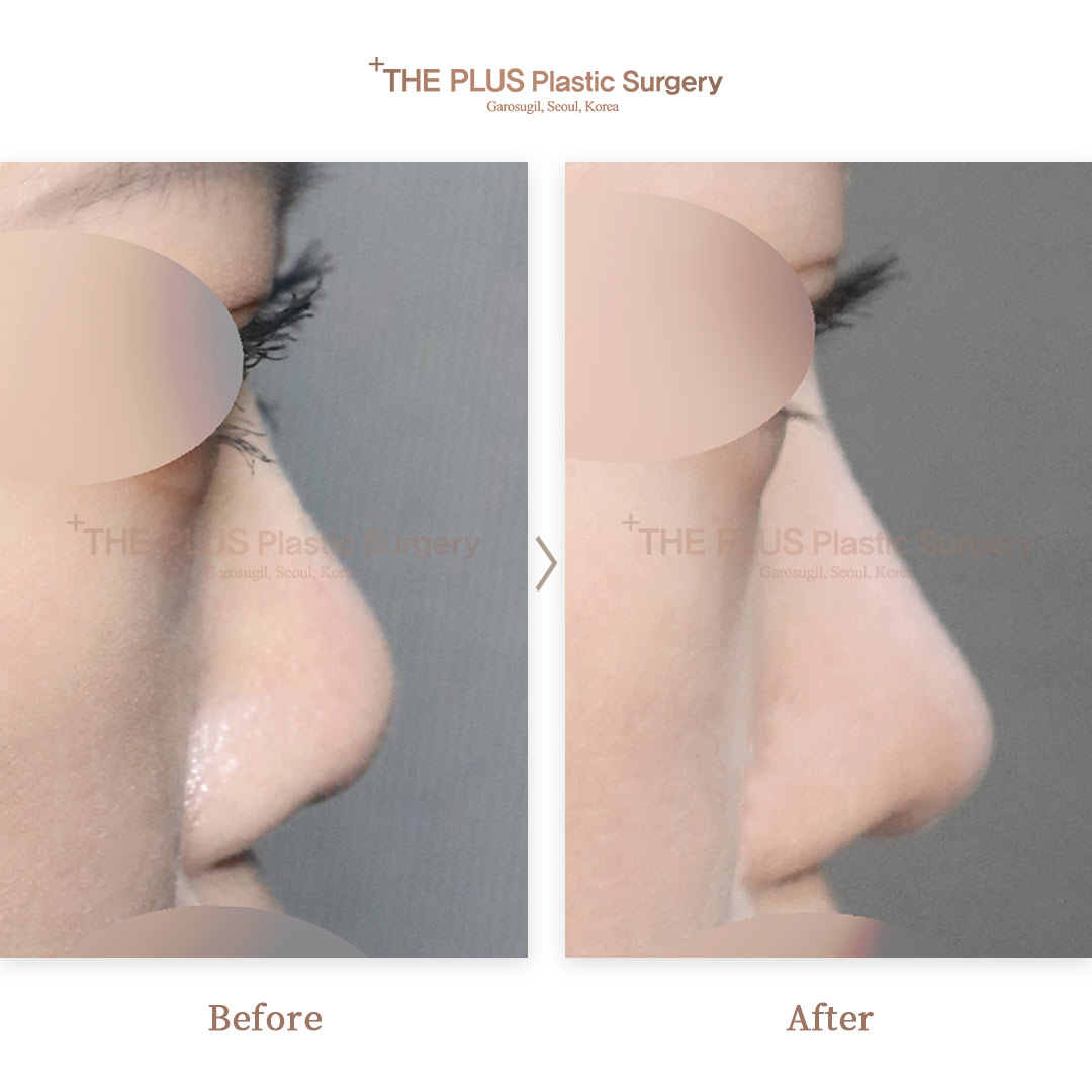 THE PLUS CLINIC KOREA -