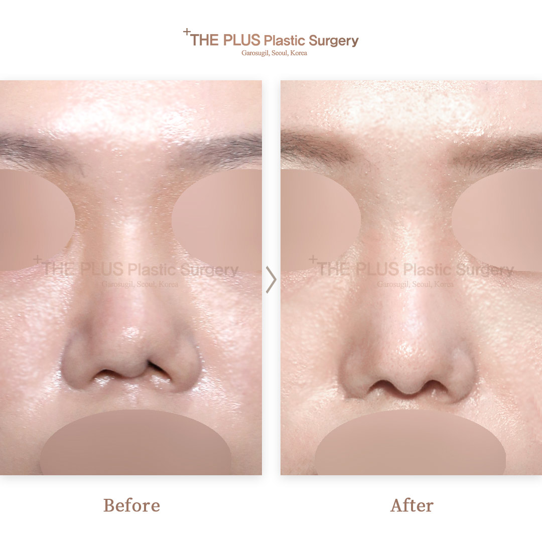THE PLUS CLINIC KOREA -