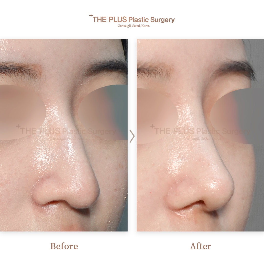 THE PLUS CLINIC KOREA -