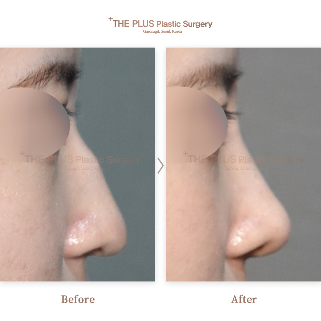 THE PLUS CLINIC KOREA -