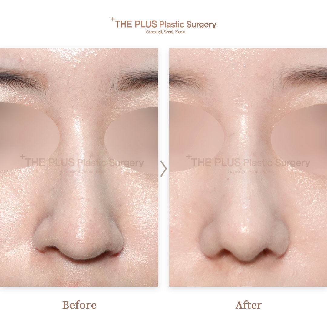 THE PLUS CLINIC KOREA -