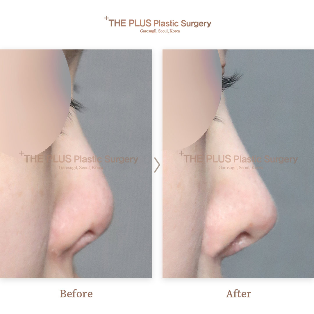 THE PLUS CLINIC KOREA -