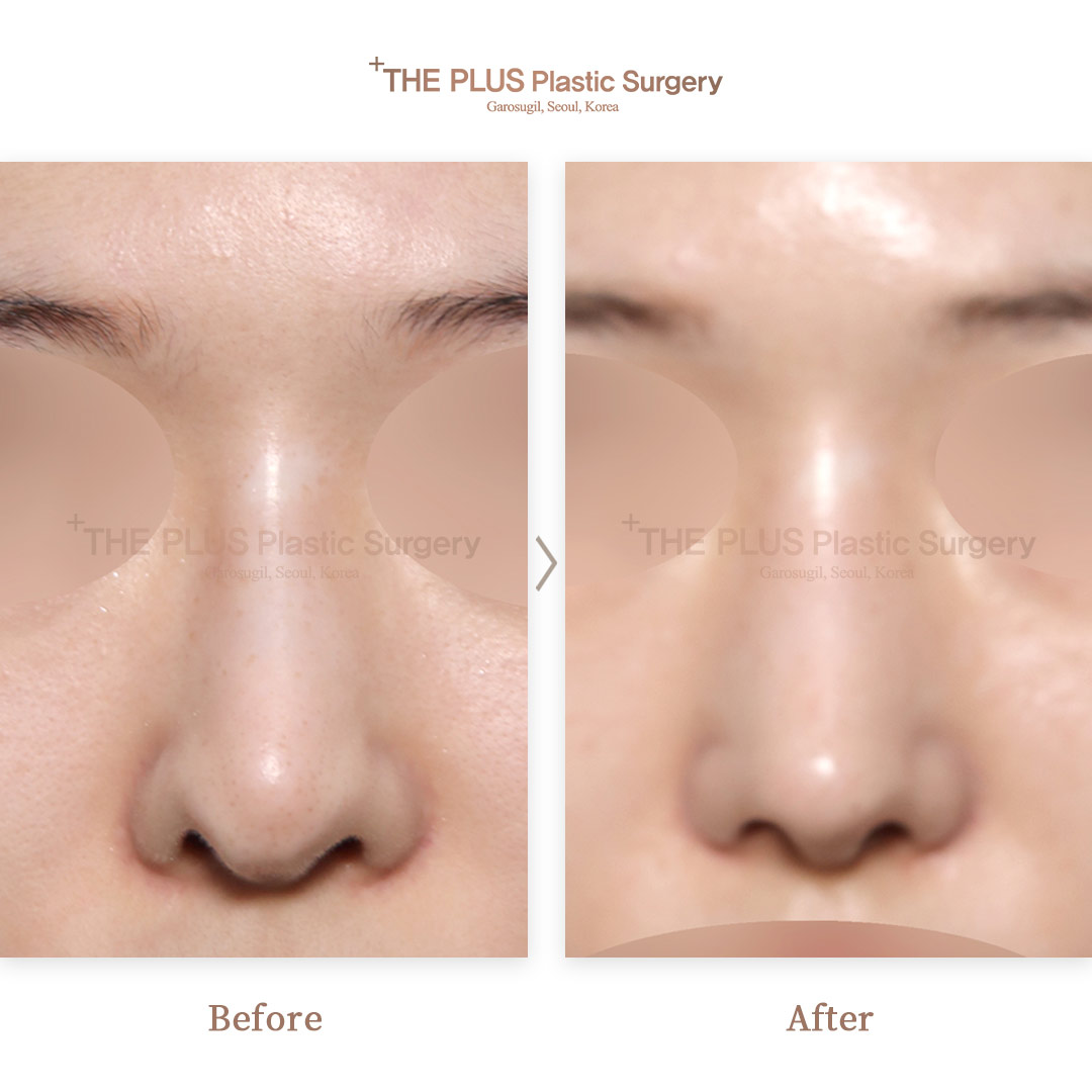 THE PLUS CLINIC KOREA -