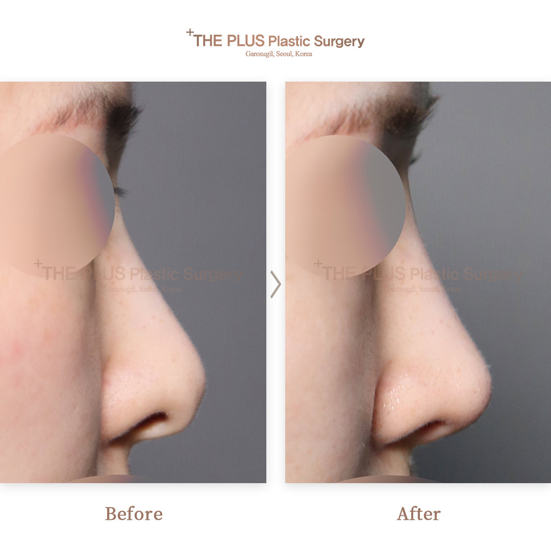 THE PLUS CLINIC KOREA -