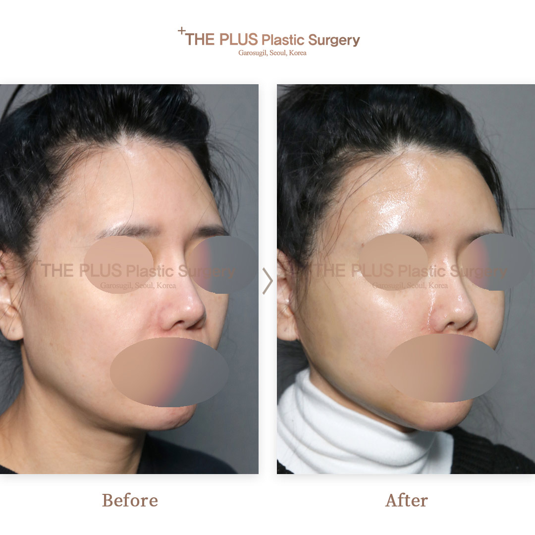 THE PLUS CLINIC KOREA -