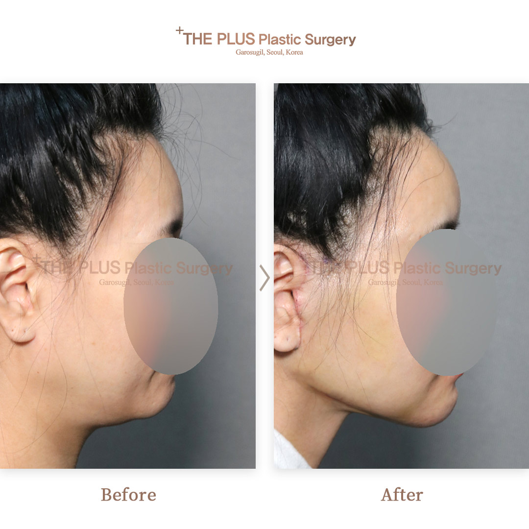 THE PLUS CLINIC KOREA -