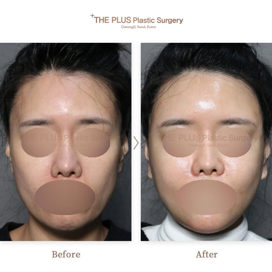 THE PLUS CLINIC KOREA -