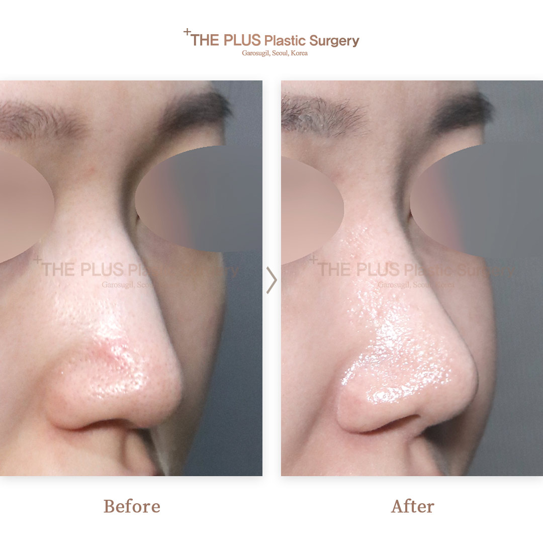 THE PLUS CLINIC KOREA -