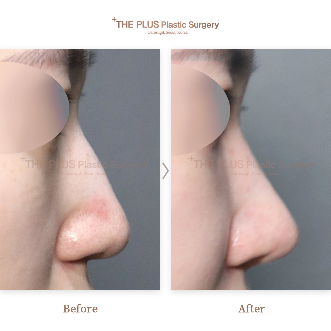 THE PLUS CLINIC KOREA -