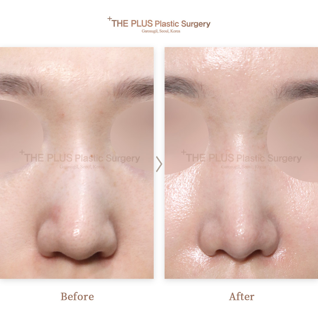 THE PLUS CLINIC KOREA -