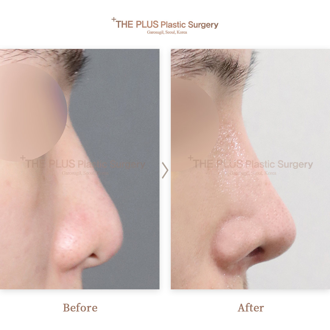 THE PLUS CLINIC KOREA -