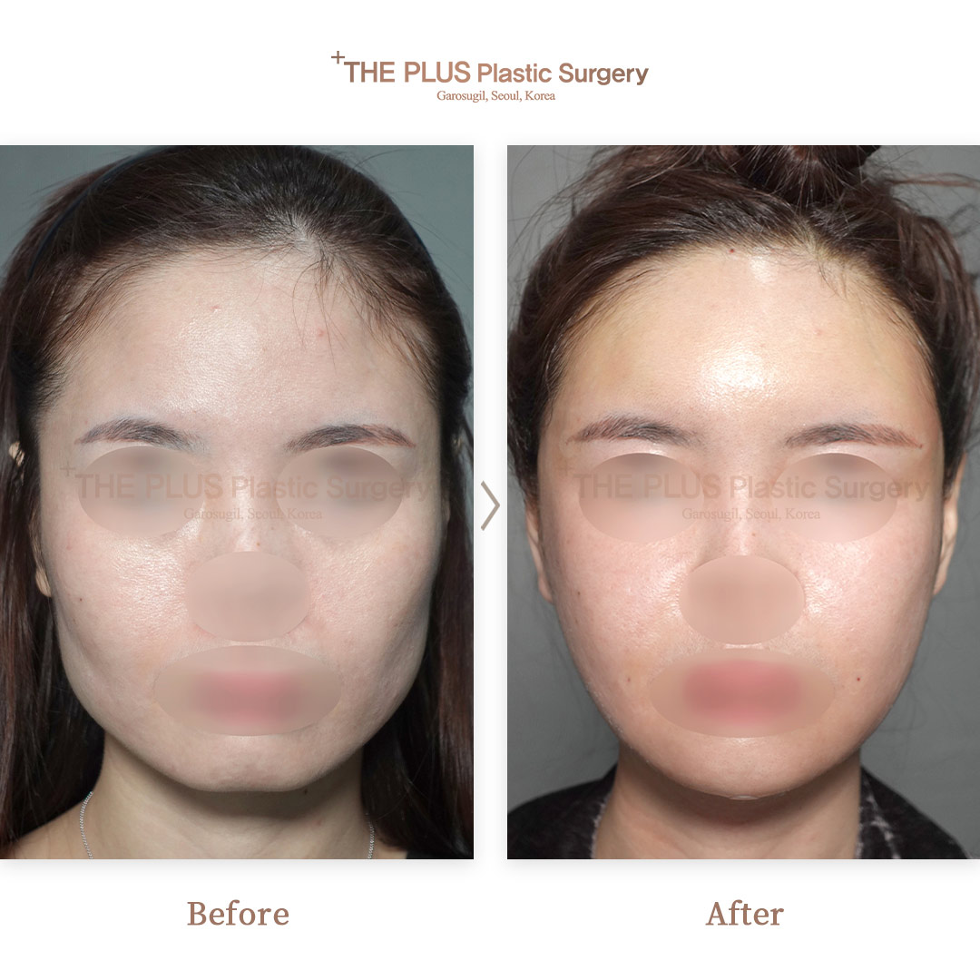 THE PLUS CLINIC KOREA -