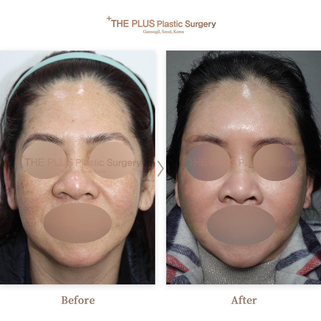 THE PLUS CLINIC KOREA -