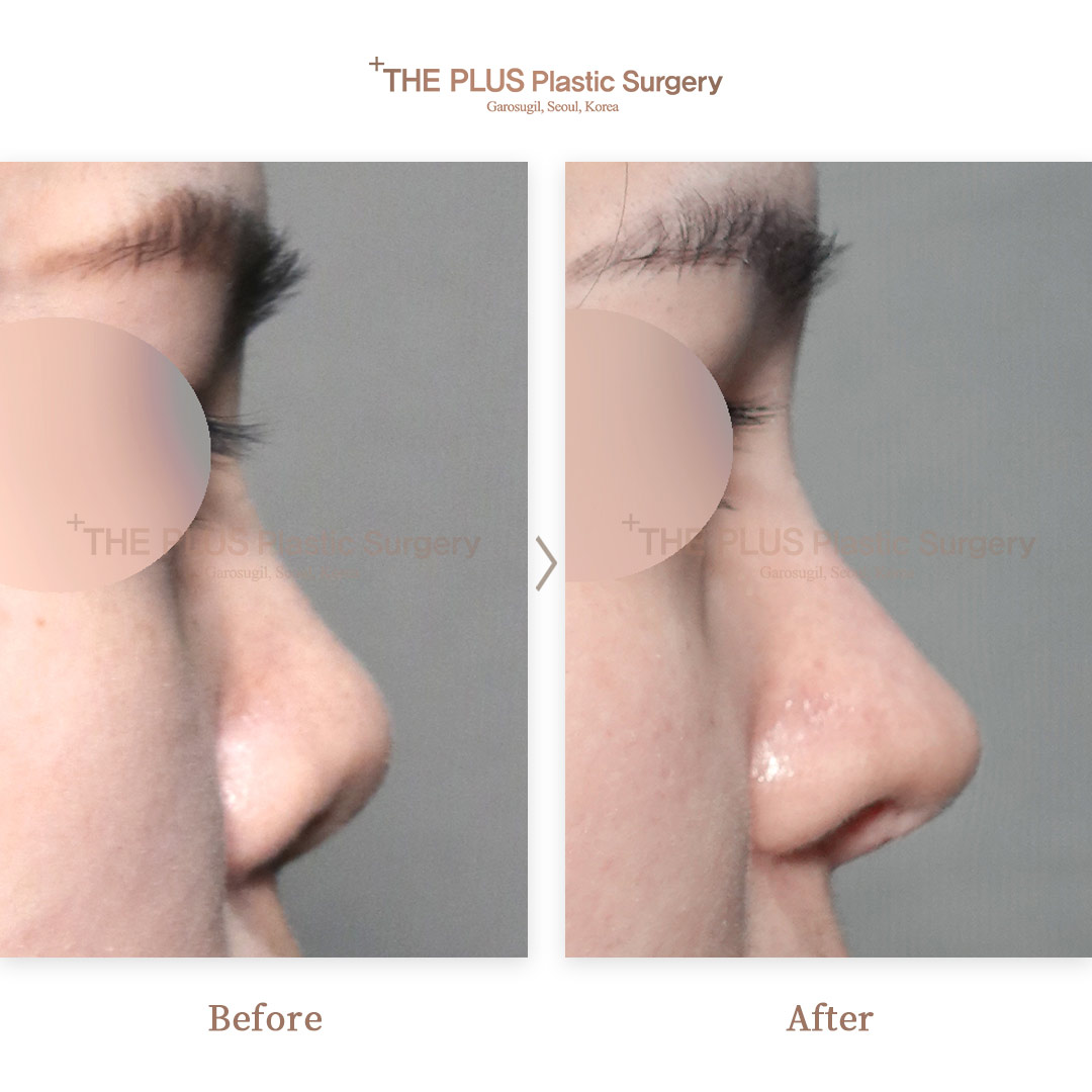 THE PLUS CLINIC KOREA -