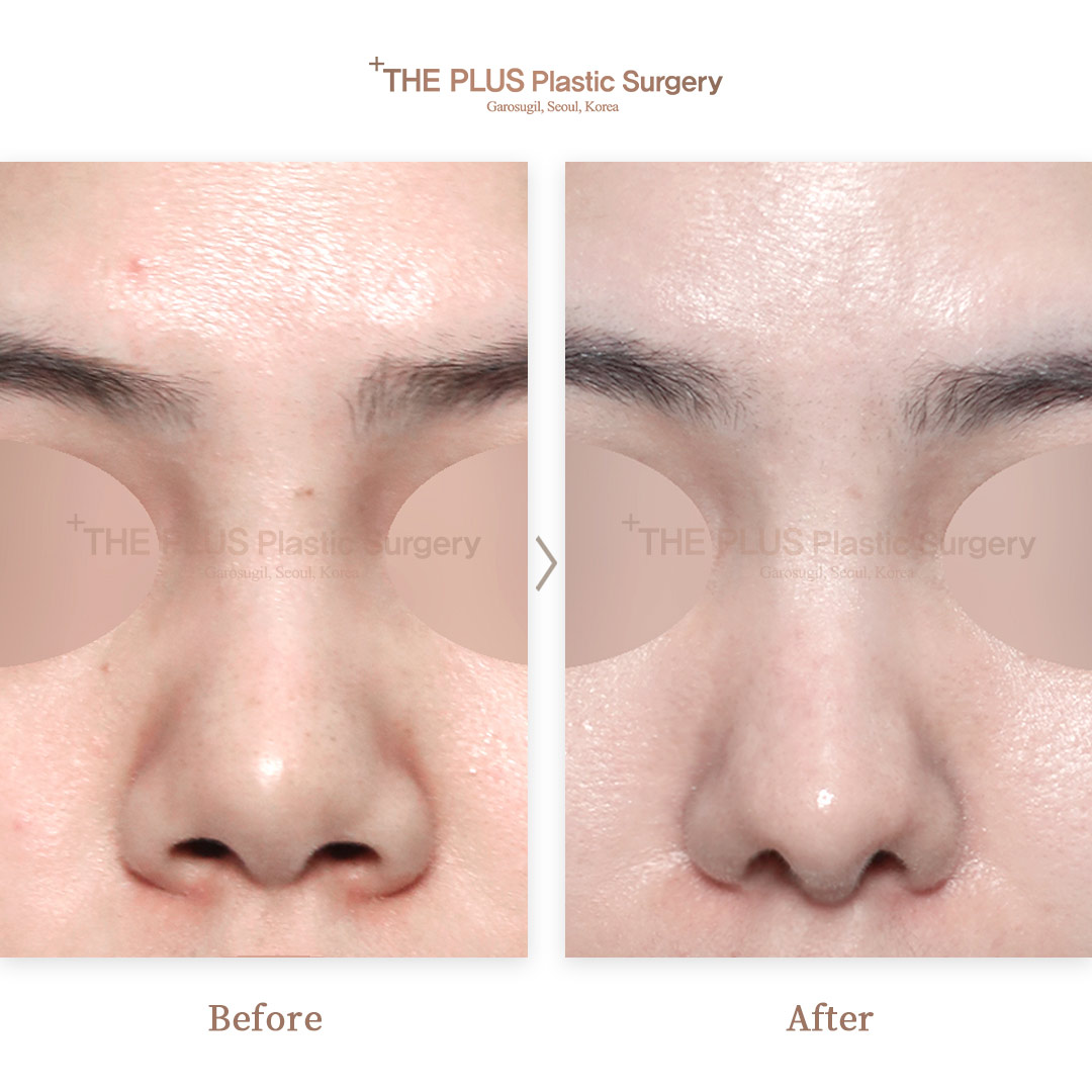 THE PLUS CLINIC KOREA -