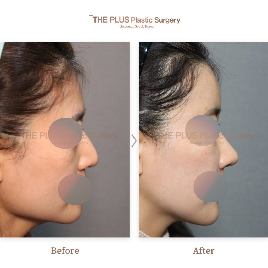 THE PLUS CLINIC KOREA -