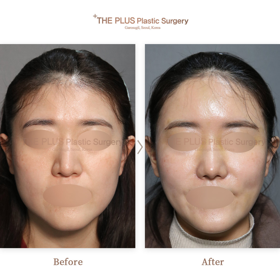 THE PLUS CLINIC KOREA -