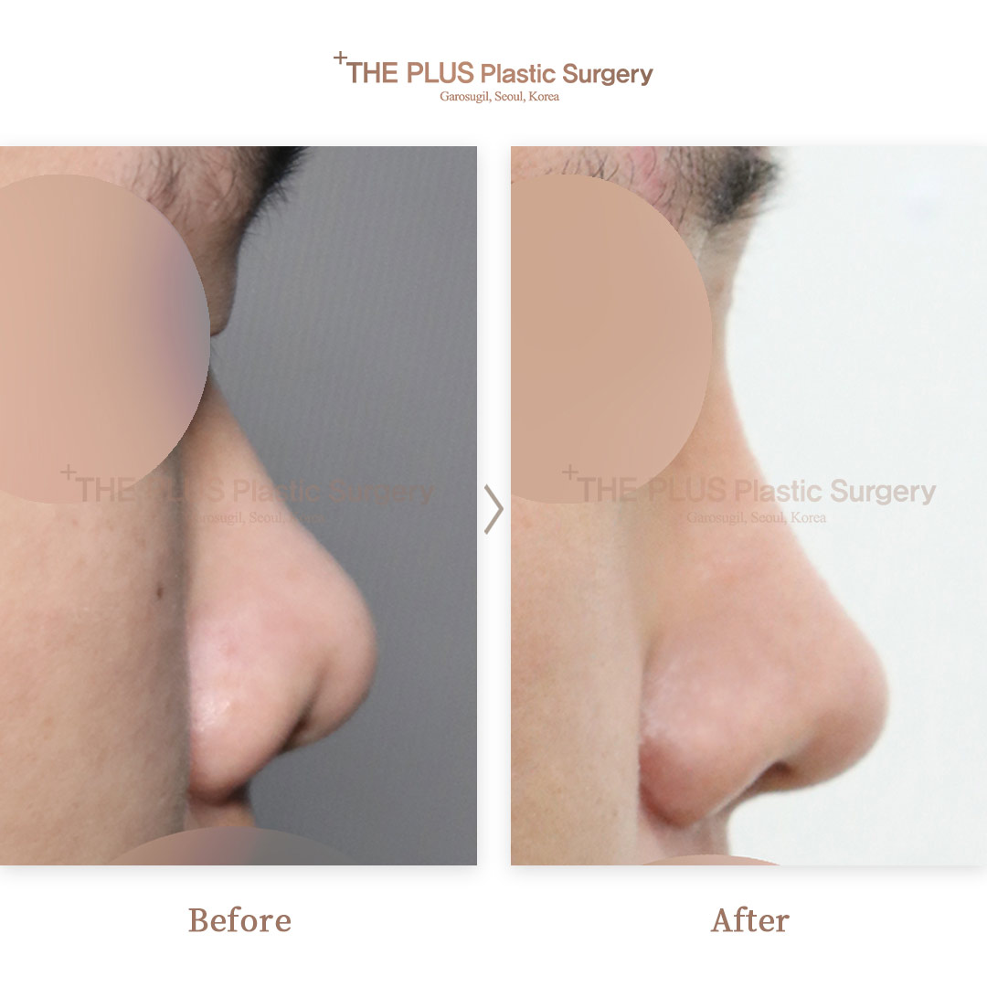 THE PLUS CLINIC KOREA -