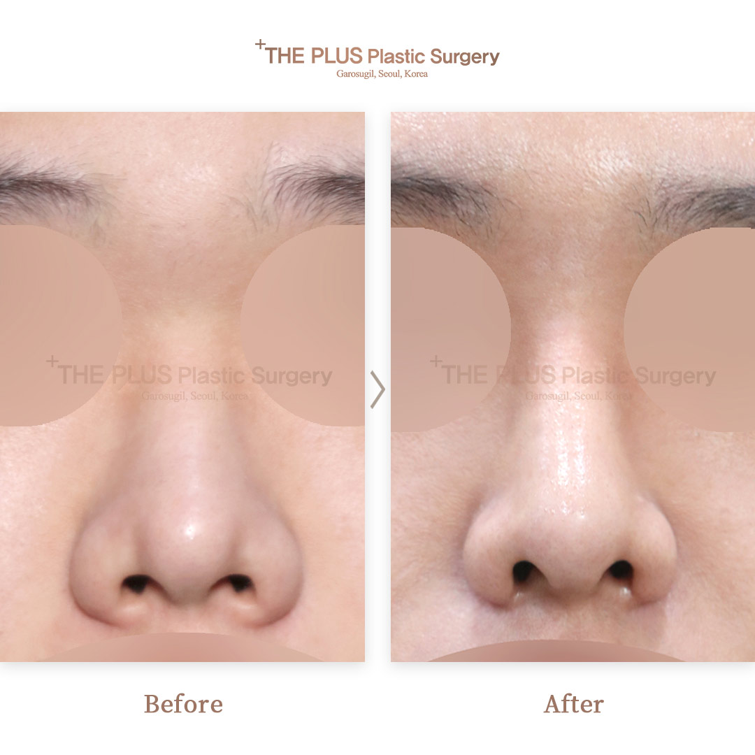THE PLUS CLINIC KOREA -