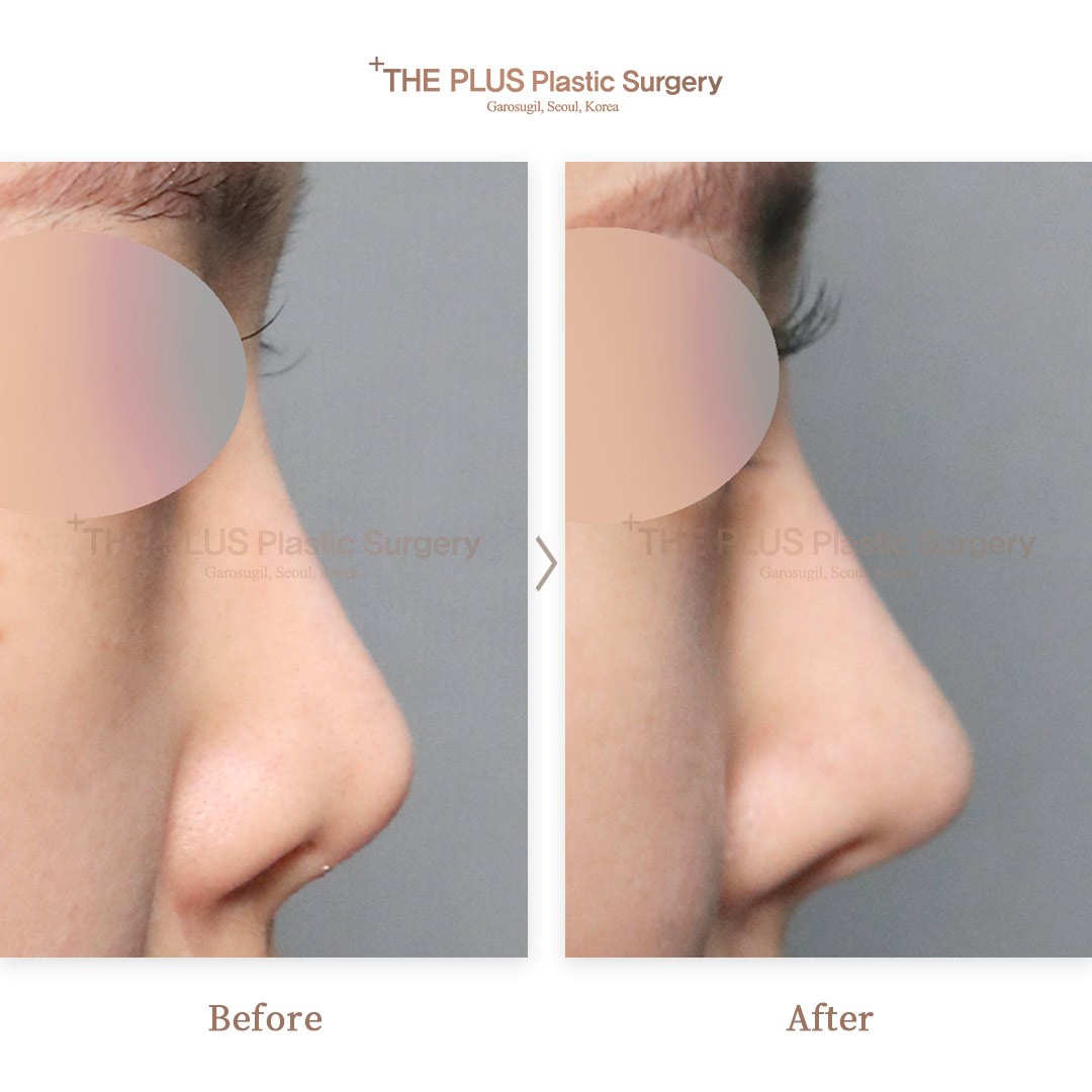 THE PLUS CLINIC KOREA -