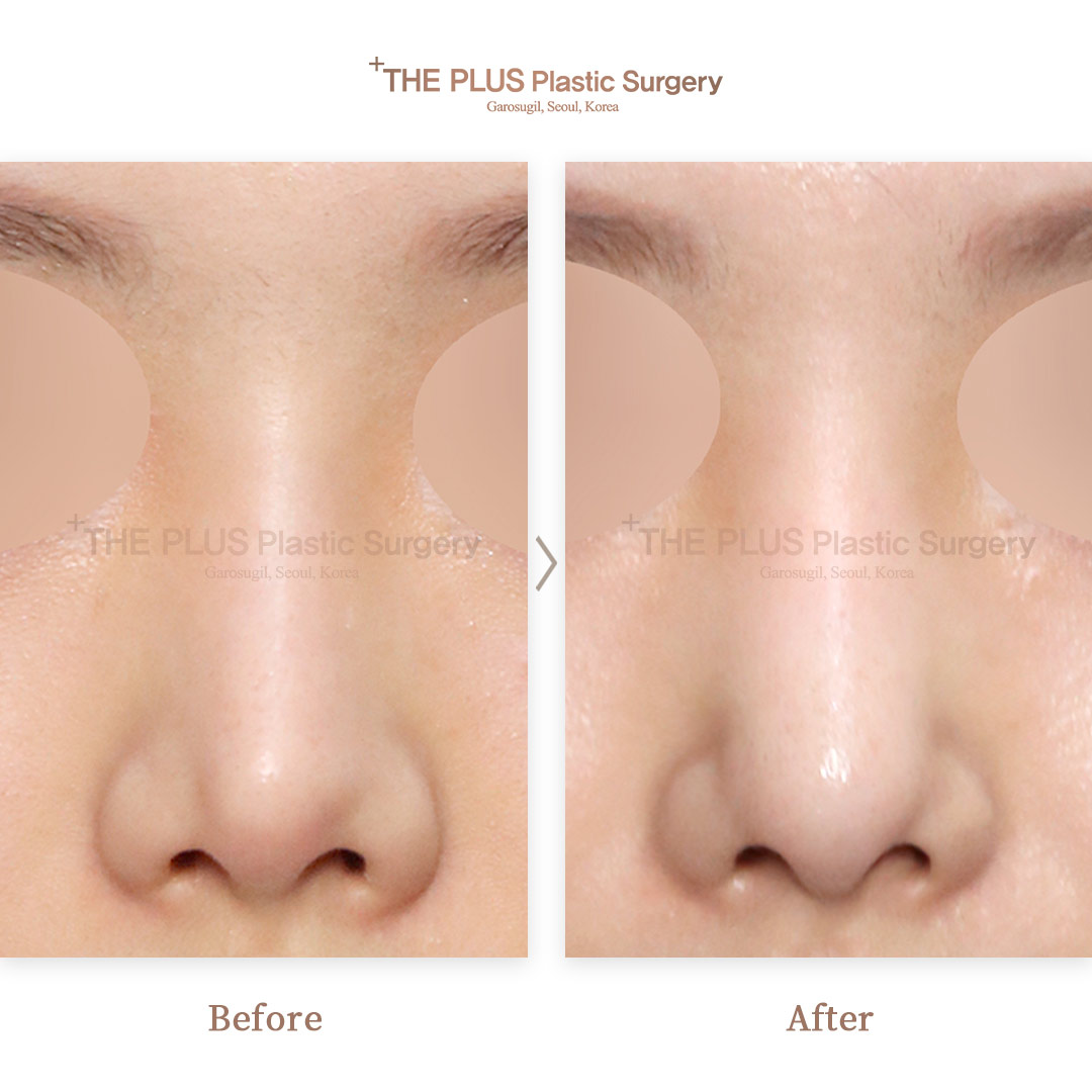 THE PLUS CLINIC KOREA -