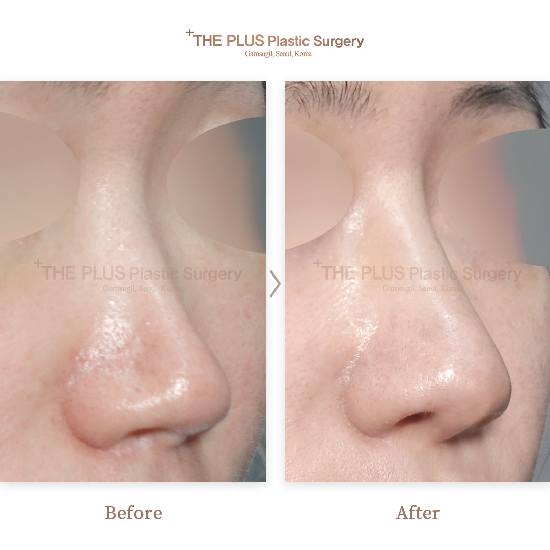THE PLUS CLINIC KOREA -