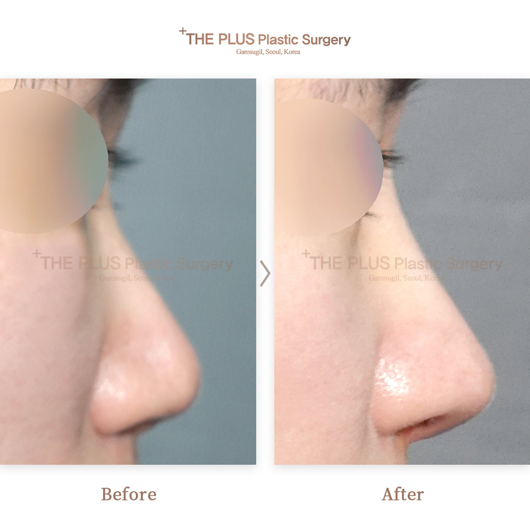 THE PLUS CLINIC KOREA -