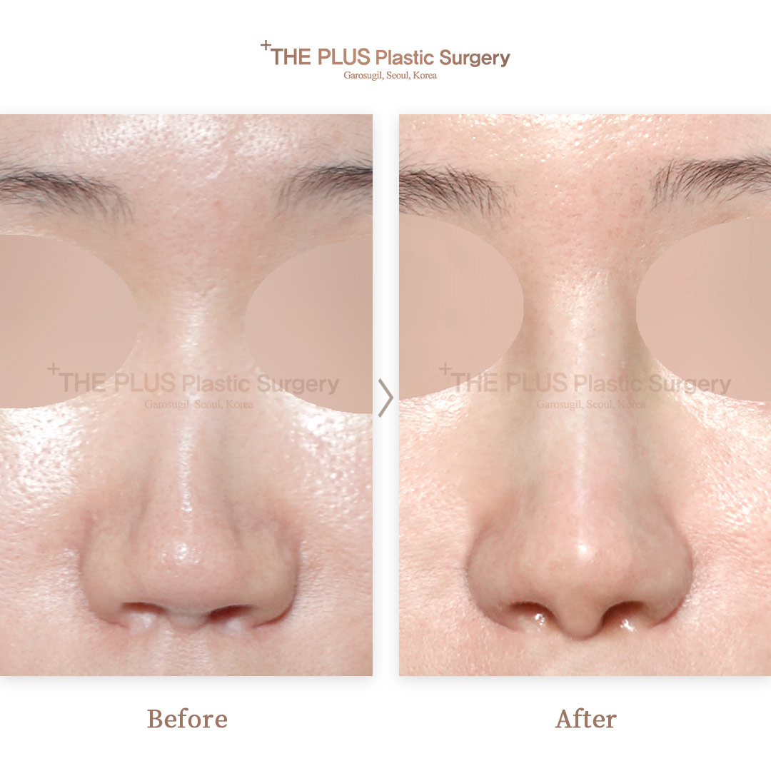 THE PLUS CLINIC KOREA -