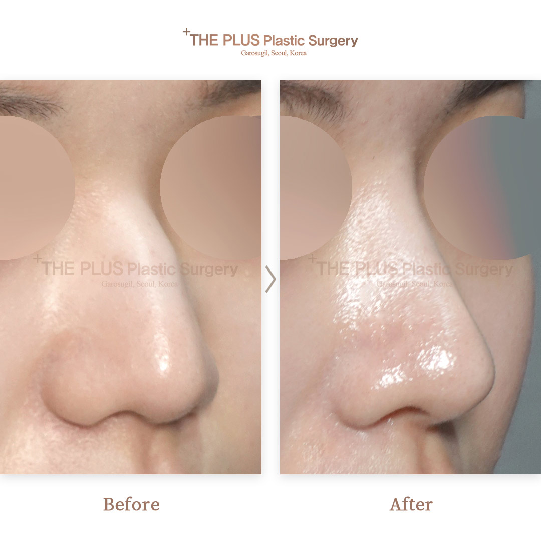THE PLUS CLINIC KOREA -