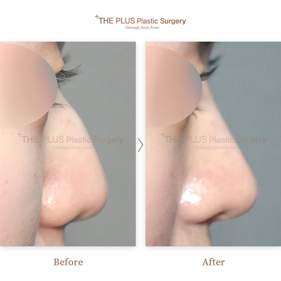THE PLUS CLINIC KOREA -