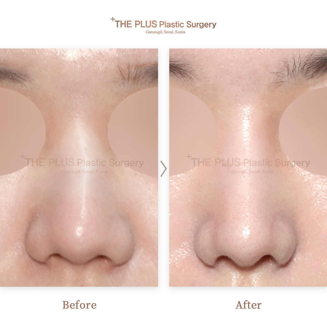 THE PLUS CLINIC KOREA -