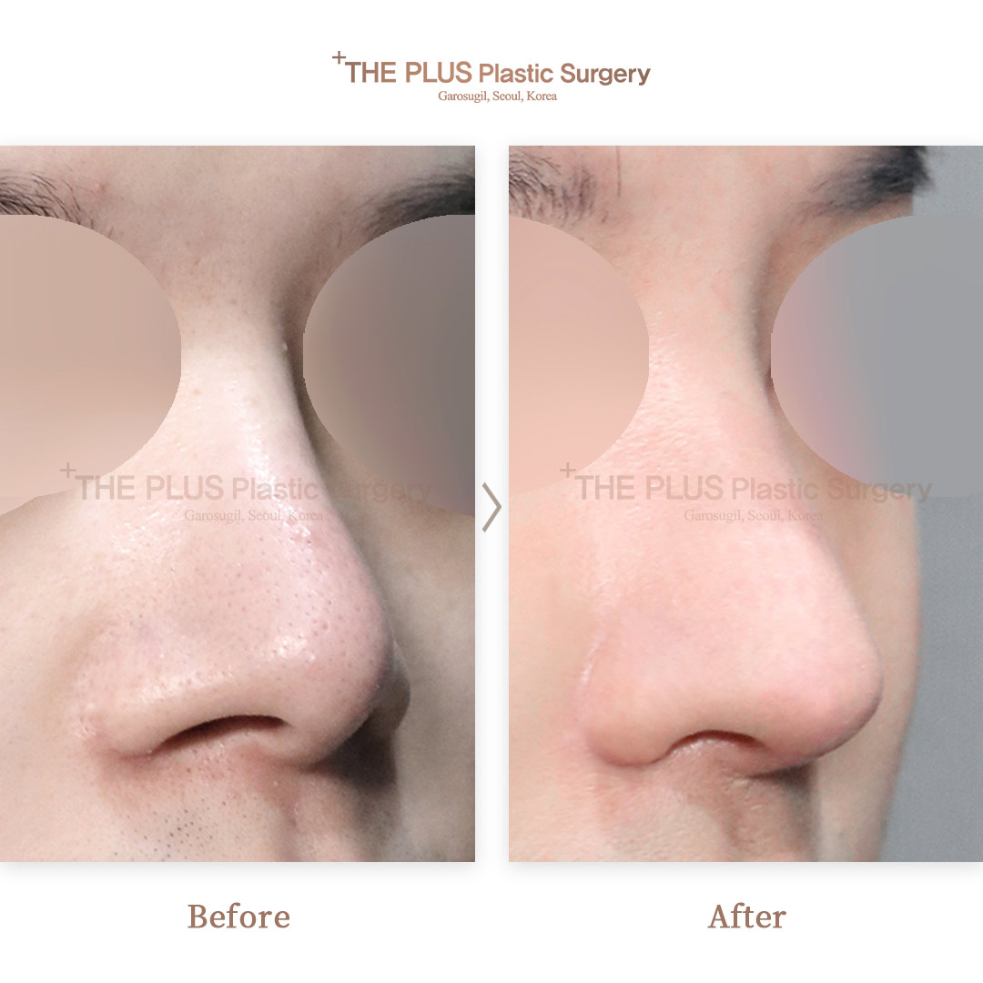 THE PLUS CLINIC KOREA -