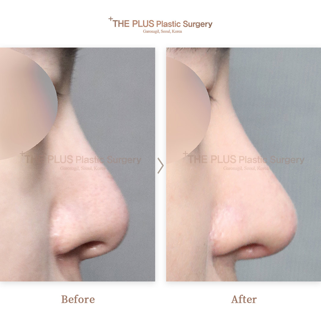 THE PLUS CLINIC KOREA -