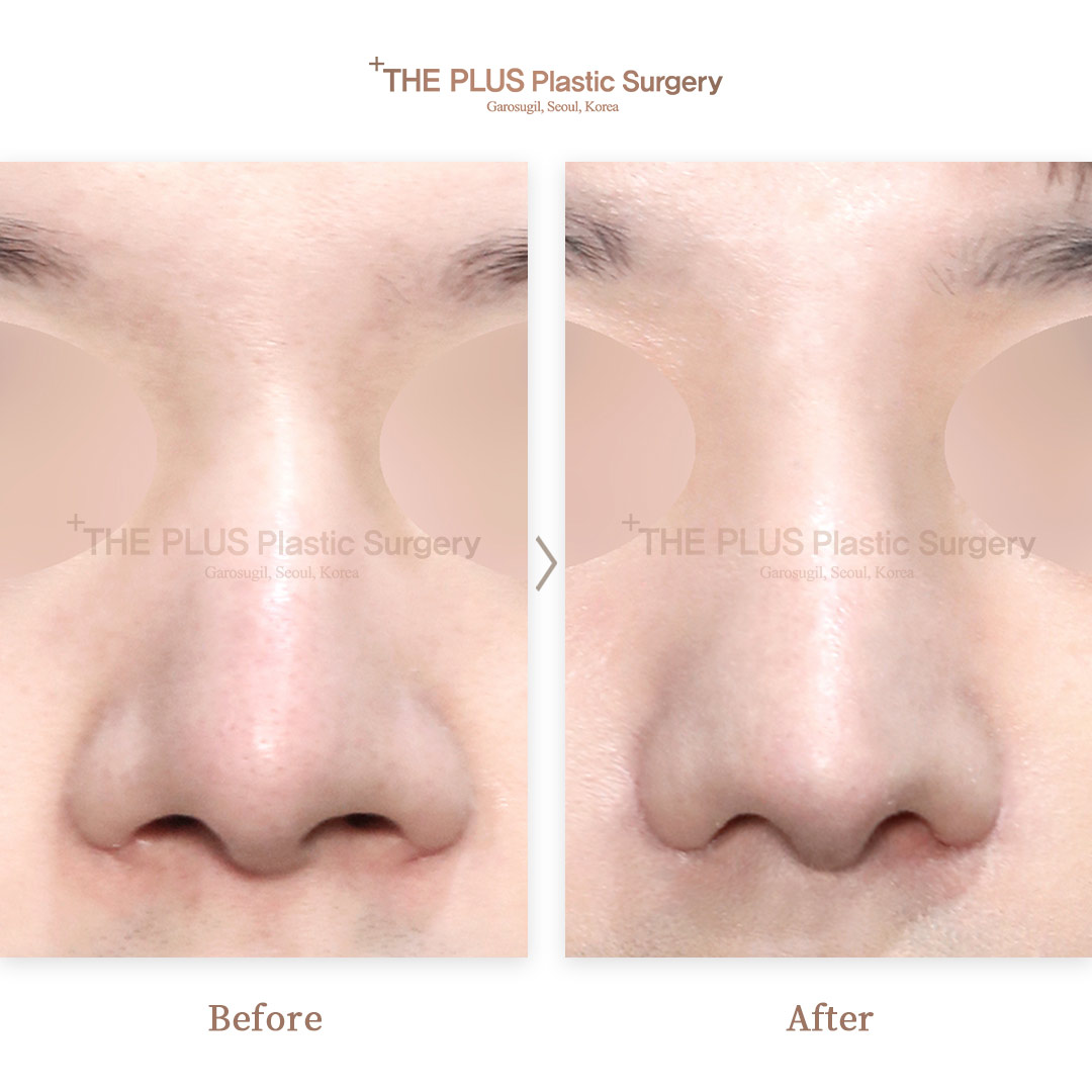THE PLUS CLINIC KOREA -