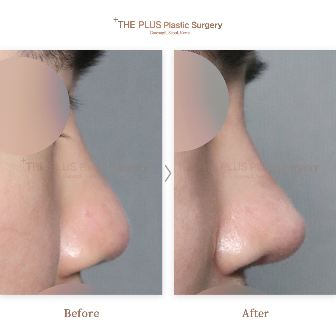 THE PLUS CLINIC KOREA -