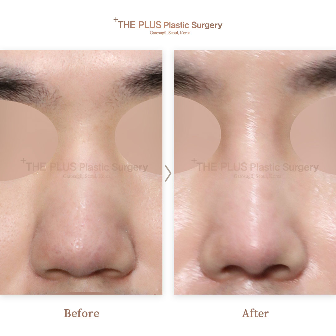 THE PLUS CLINIC KOREA -