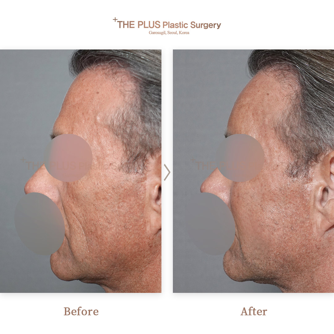 THE PLUS CLINIC KOREA -