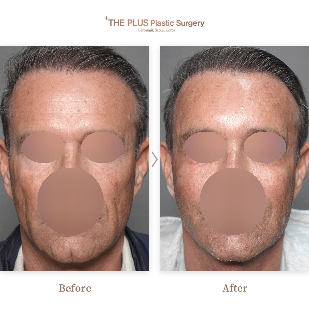 THE PLUS CLINIC KOREA -