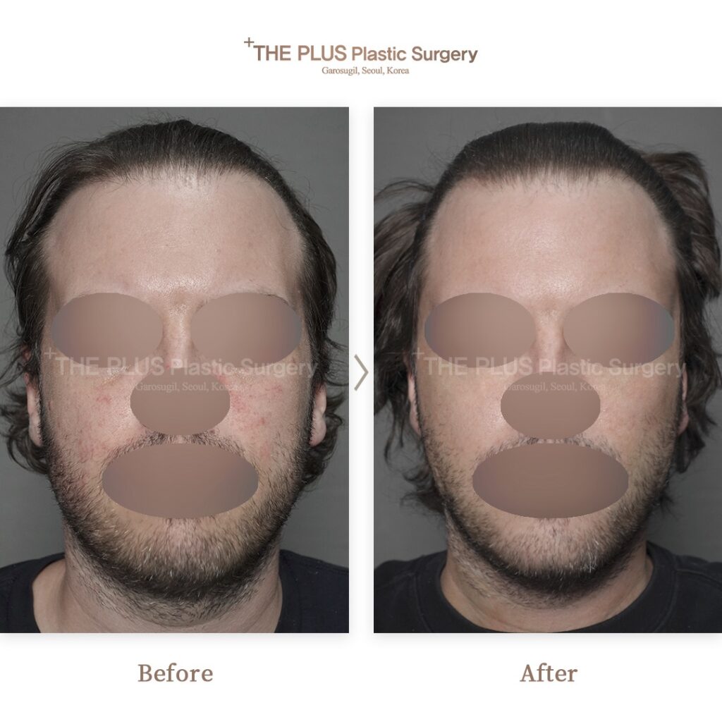 THE PLUS CLINIC KOREA -