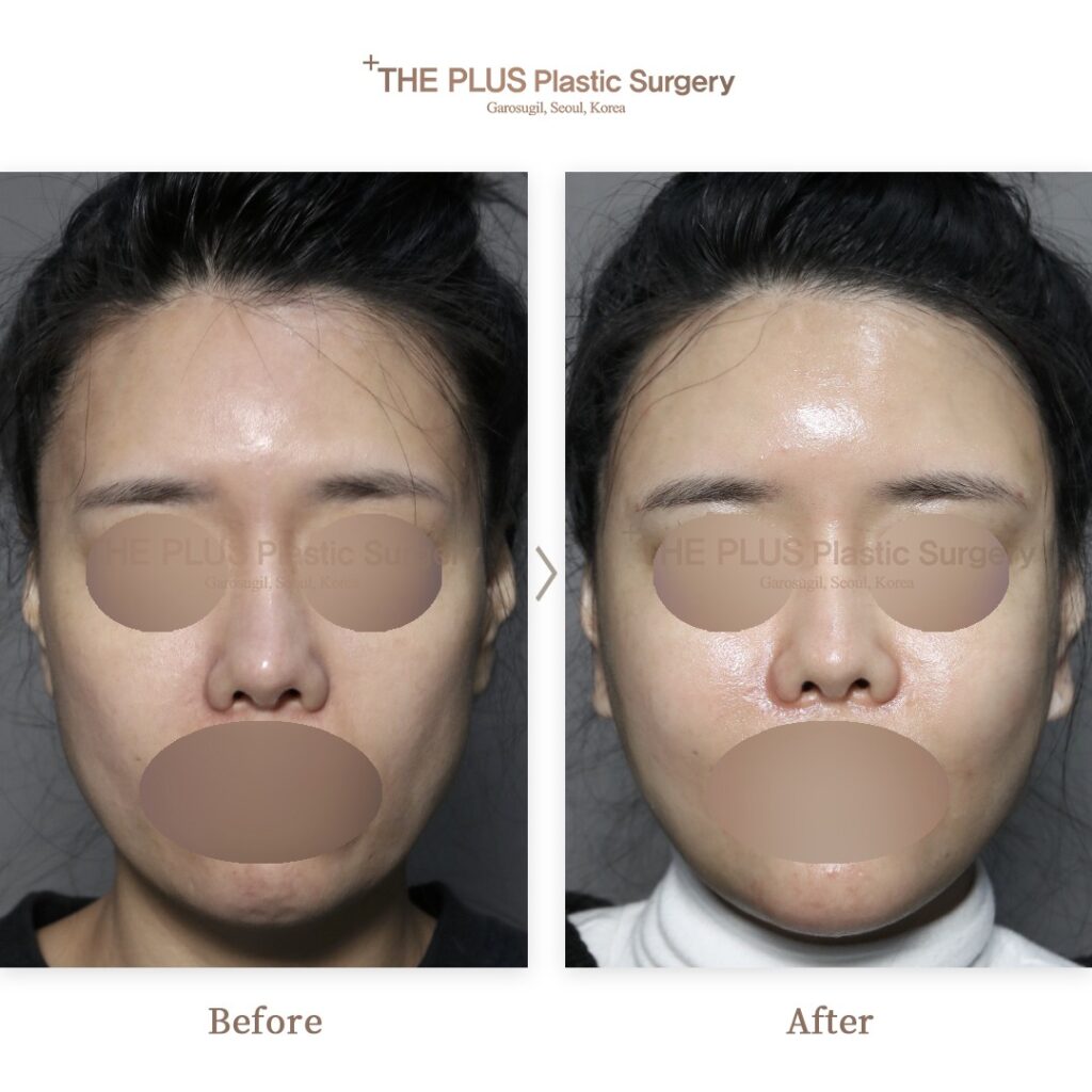 THE PLUS CLINIC KOREA -