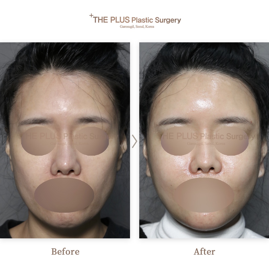 THE PLUS CLINIC KOREA -