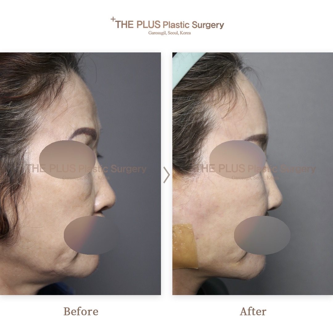 THE PLUS CLINIC KOREA -