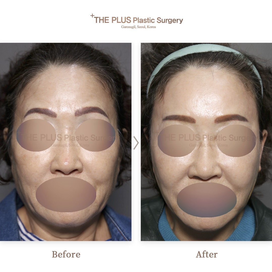 THE PLUS CLINIC KOREA -