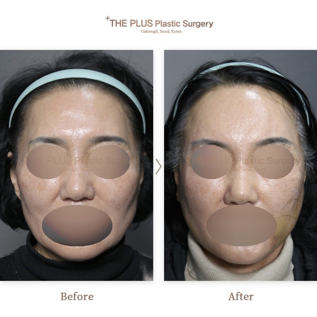 THE PLUS CLINIC KOREA -