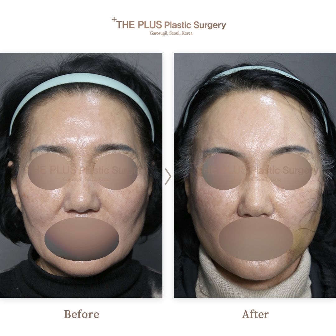 THE PLUS CLINIC KOREA -