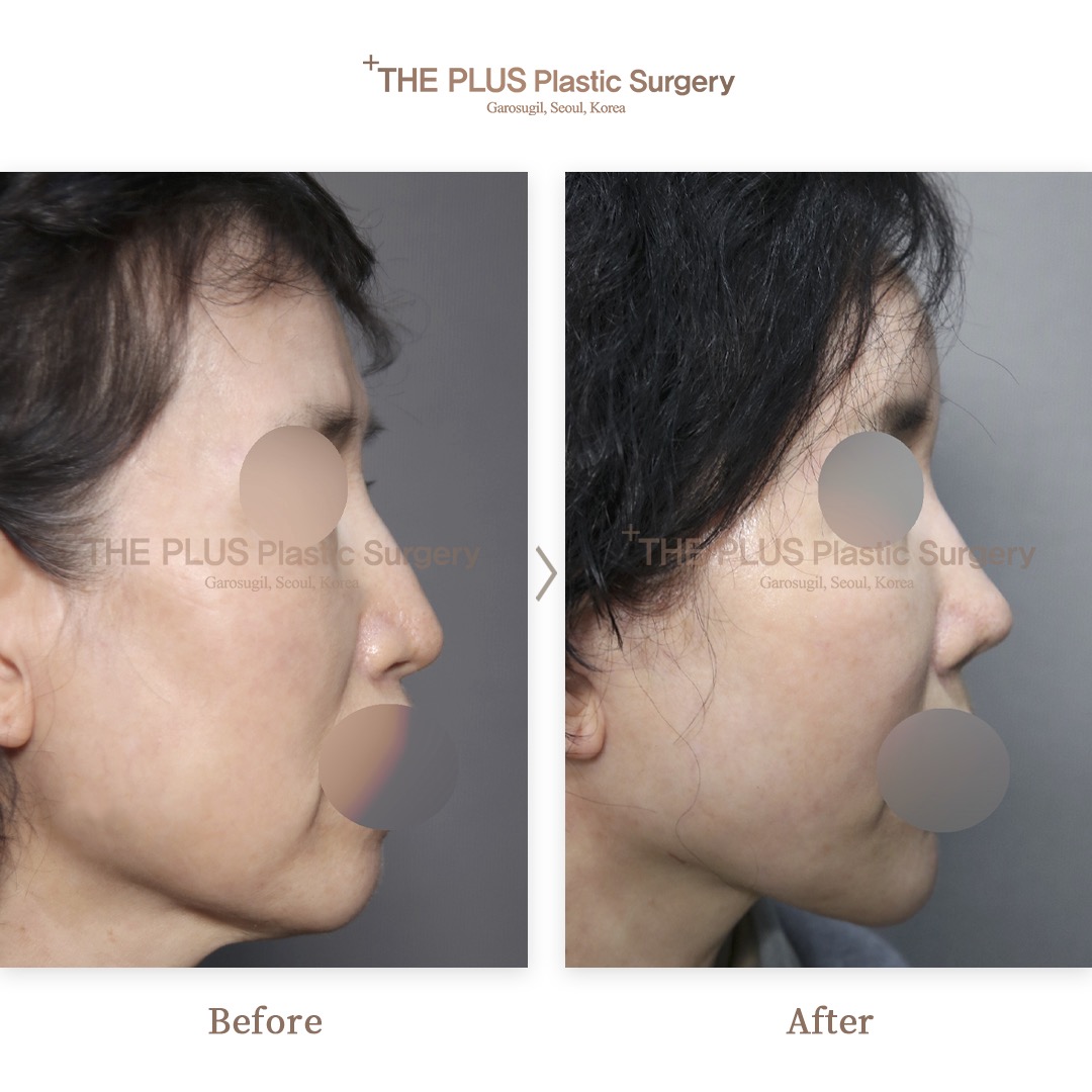 THE PLUS CLINIC KOREA -