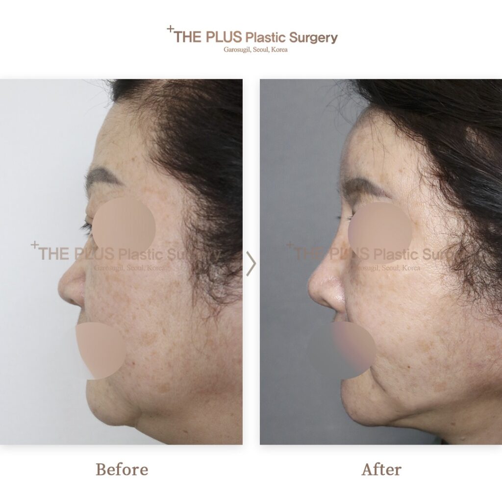 THE PLUS CLINIC KOREA -